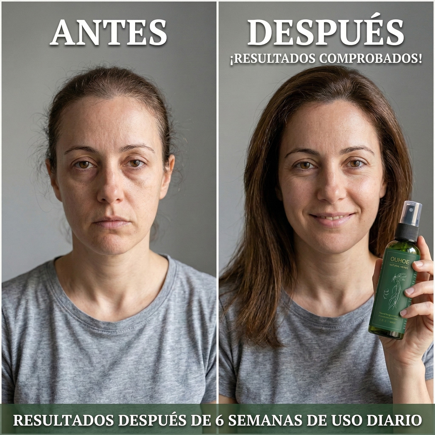Elixir OUHOE 100ml con Ginseng – Crecimiento Capilar, Fortalecimiento y Control de Caída